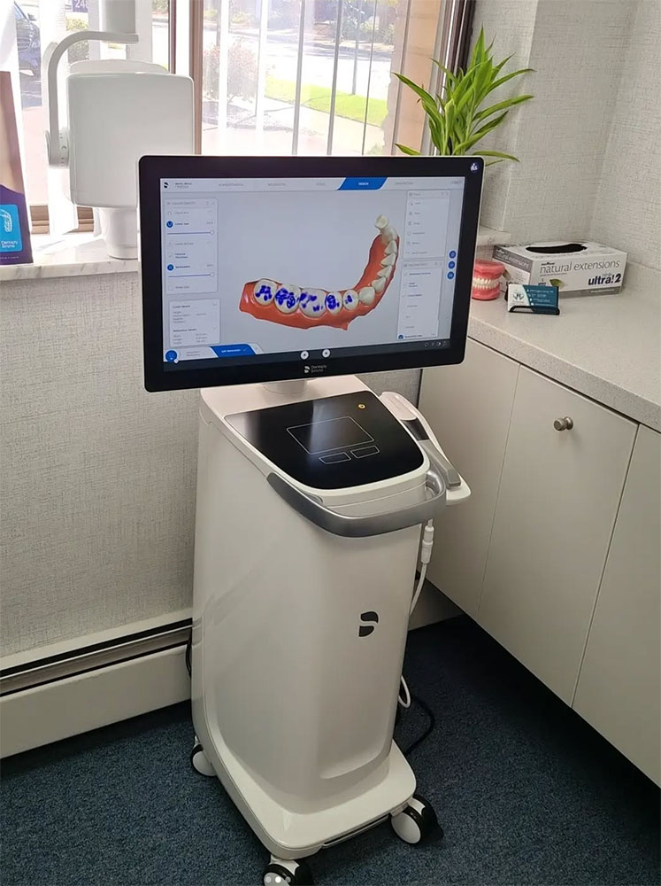 A dental intraoral scanner with a monitor displaying a 3D tooth model, showcasing Advanced Technology at Renewal Family Dental.